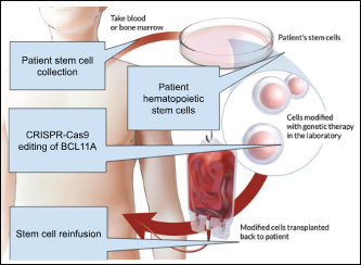 Figure 4. Ex vivo CRISPR-Cas9 gene-editing workflow in hematopoietic stem cells for sickle cell disease, including CRISPR-Cas9 targeting of the BCL11A erythroid enhancer resulting in increased fetal hemoglobin production and reduced erythrocyte sickling.
Adapted from the National Heart, Lung, and Blood Institute (NHLBI, 2022).
