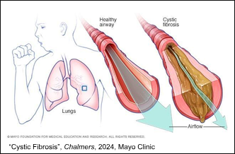 The “New Kid” of Medicine: CFTR Modulator Therapies image