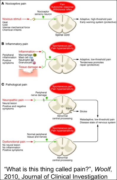 Diagram explaining what pain is