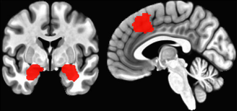 Toxic Masculinity: the Scientific and Societal Perspectives of the Mask image